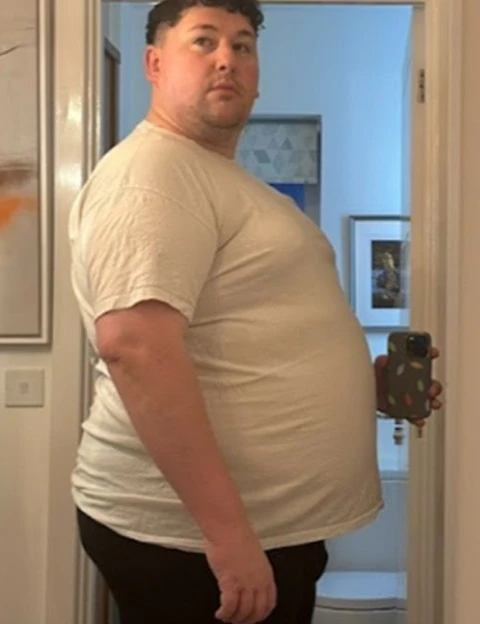 before-image